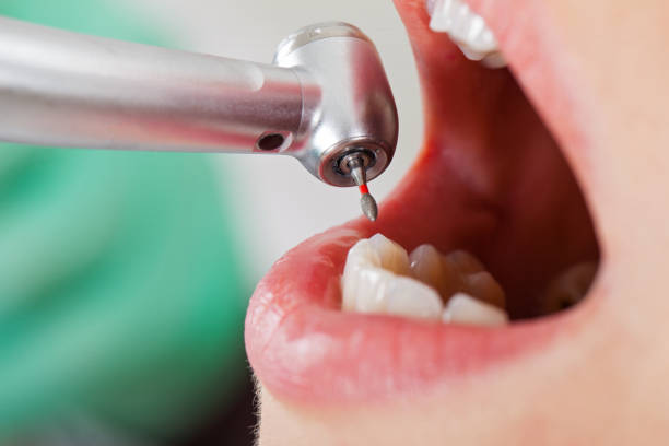 Best Emergency Dental Services for Seniors in Colleyville, TX